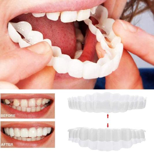 Smile Veneer™ - Includes Top & Bottom