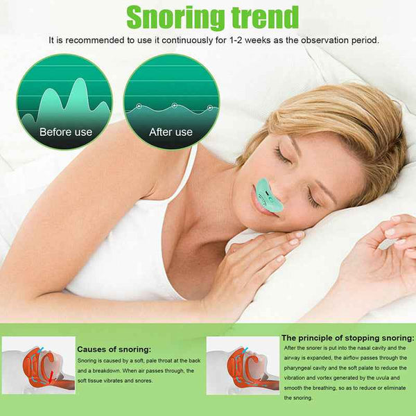 Electric Micro CPAP Anti Snoring Device